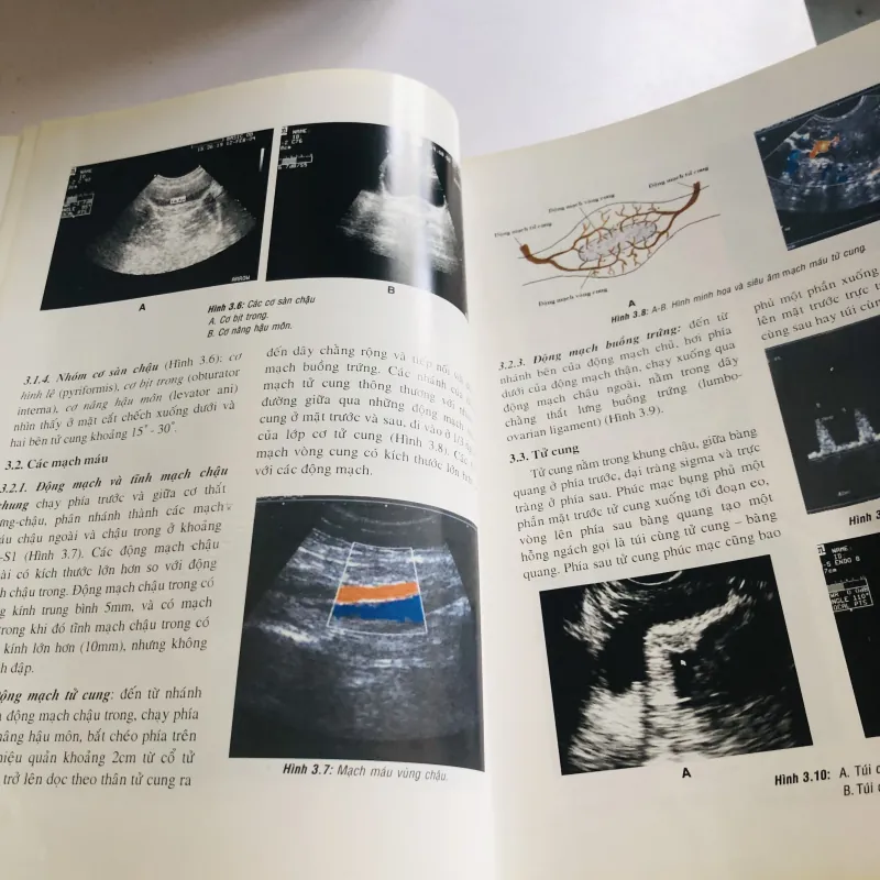 SIÊU ÂM PHỤ KHOA THỰC HÀNH  756269