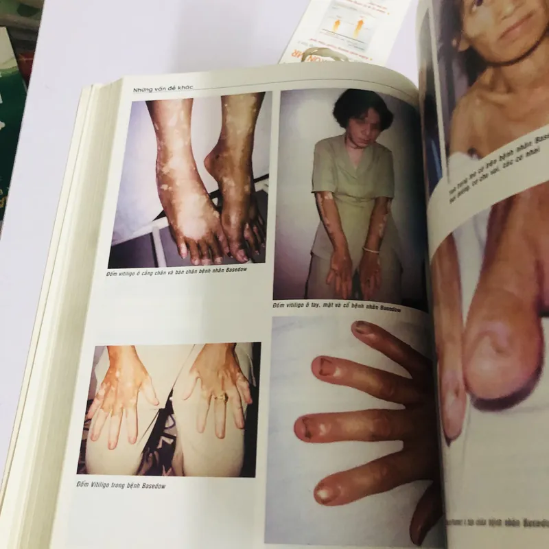 📚 NỘI TIẾT HỌC ĐẠI CƯƠNG 👩‍⚕️ Tác giả: Mai Thế Trạch – Nguyễn Thu Khuê 593719