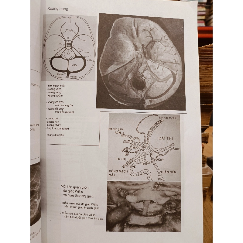 Hình ảnh học sọ não - Jacques Clarisse, Nguyễn Thi Hùng, Phạm Ngọc Hoa 929913