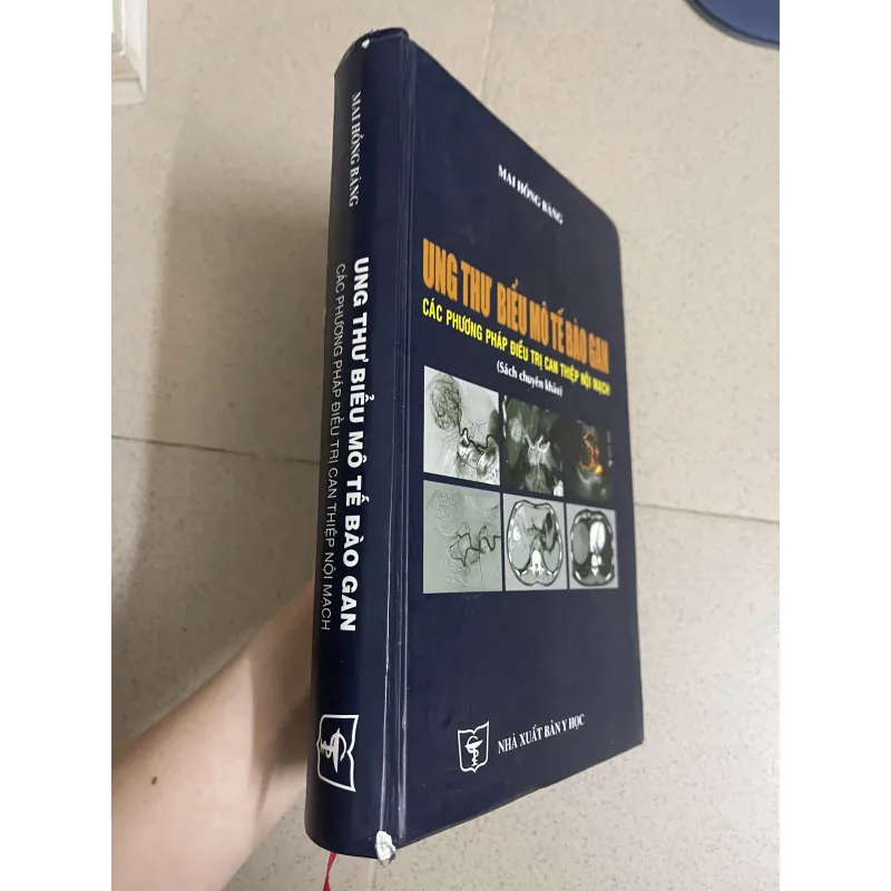 Ung thư biểu mô tế bào gan – Các phương pháp điều trị can thiệp nội mạch  763552