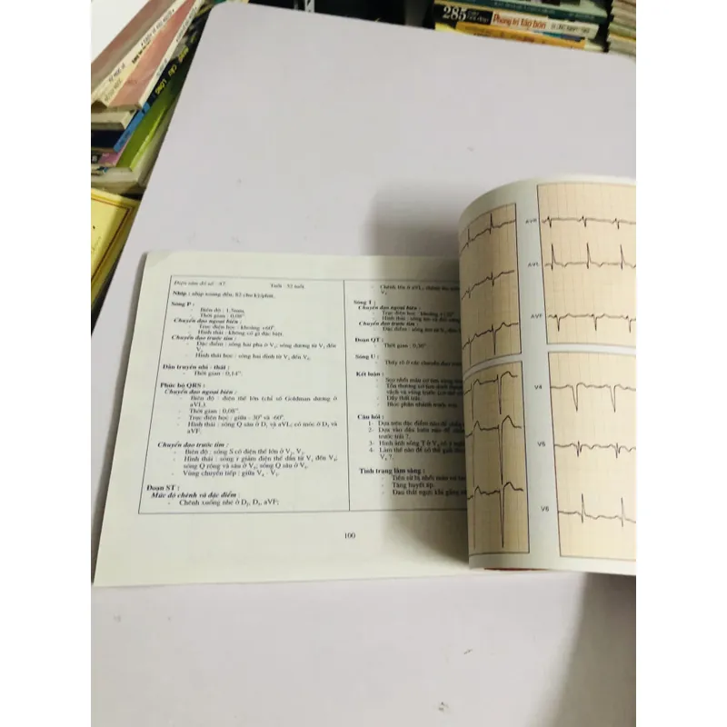 BÀI TẬP ĐIỆN TÂM ĐỒ (M. Englert – R. Bernard) 598068