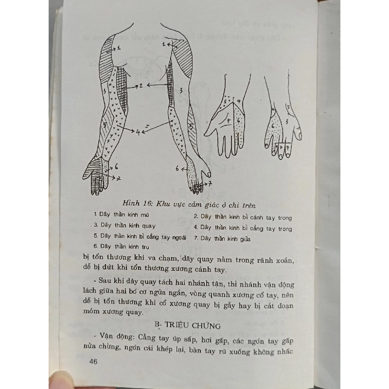 Bệnh học thần kinh - Hồ Hữu Lương 795925