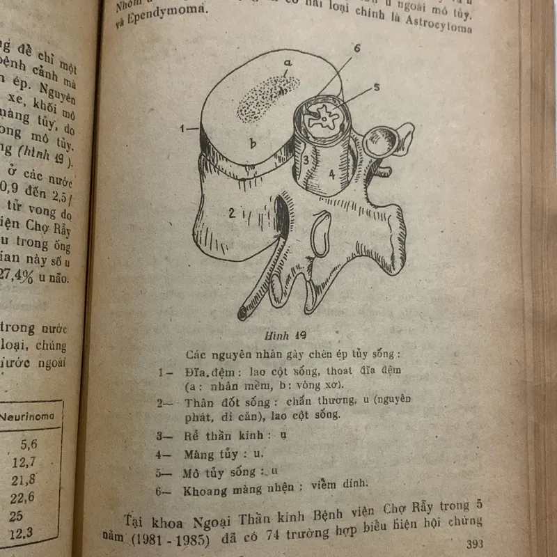 Bệnh lý ngoại khoa thần kinh, Lê Xuân Trung, lưu hành nội bộ 709163