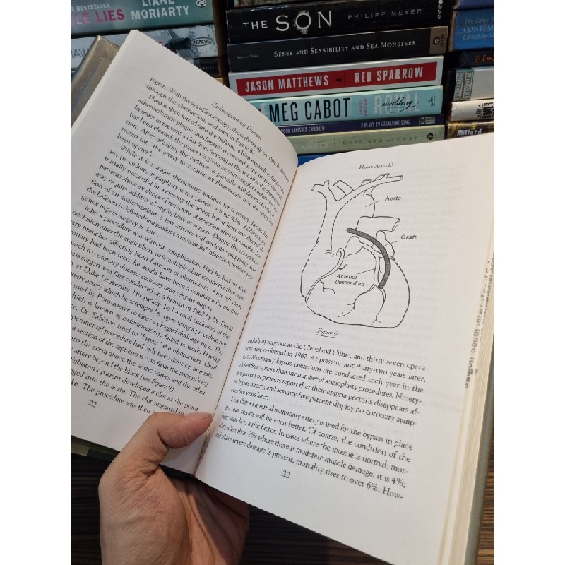 UNDERSTANDING DISEASE : How Your Heart, Lungs, Blood, And Blood Vessels Function & Respond To Treatment - G.A. Langer, M.D 164224