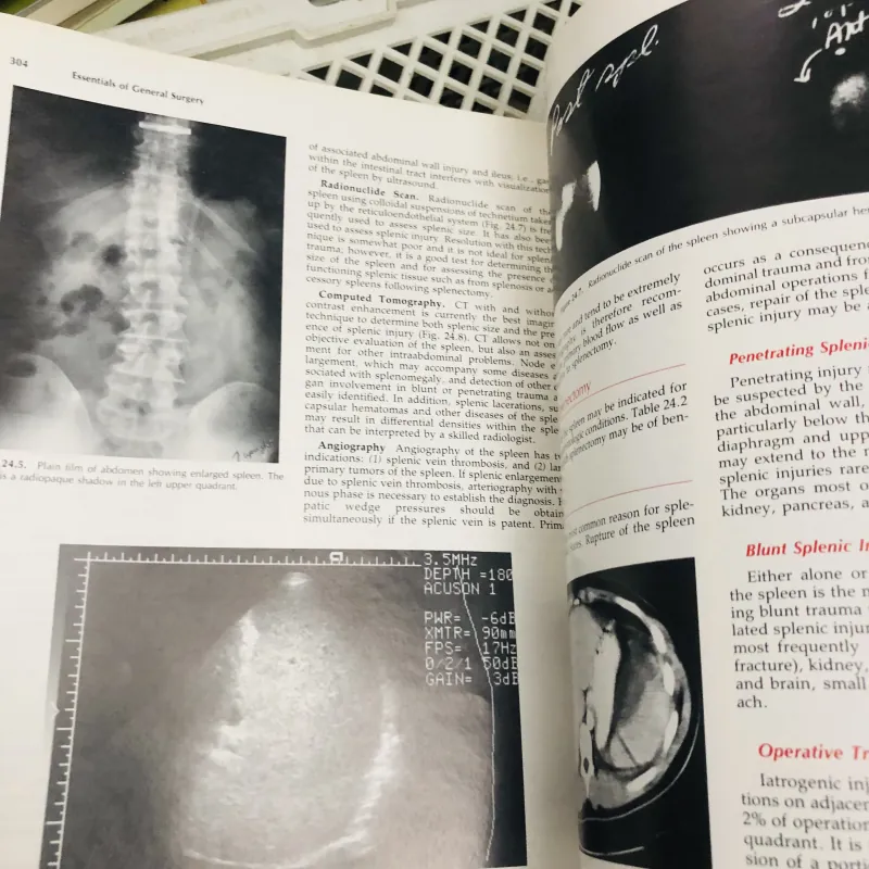 ESSENTIALS OF GENERAL SURGERY – Peter F. Lawrence Sách y học kinh điển về ngoại tổng quát 799196