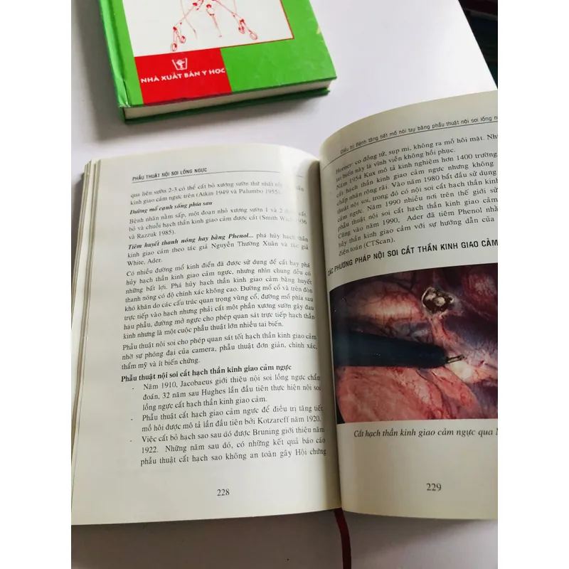 PHẪU THUẬT NỘI SOI LỒNG NGỰC  675226