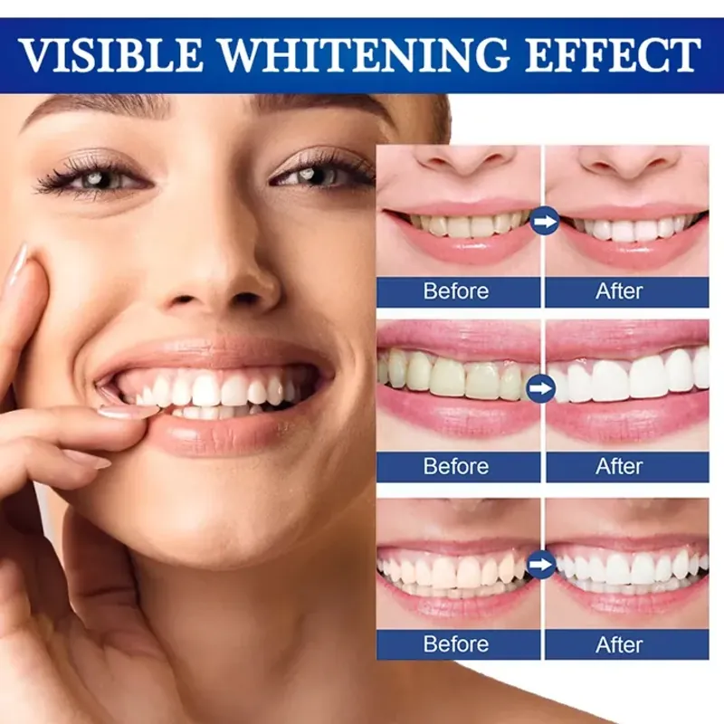 Gel bôi làm trắng, sáng răng, giảm ố vàng, cao răng, giảm hôi miệng 800858