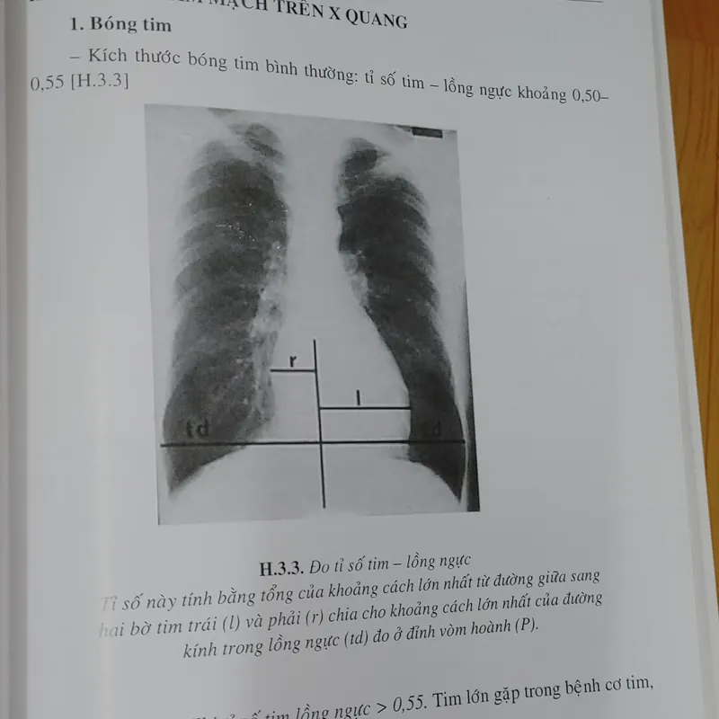 CHẨN ĐOÁN X QUANG  572267
