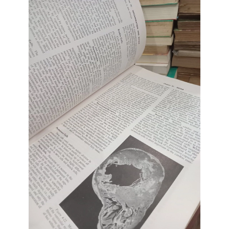 Textbook of pathology with clinical application - Stanley L. Robbins 969739