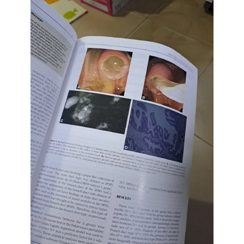 GIE Gastrointestinal Endoscopy volume 76 no 2 8/2012 HCM0808 TẠP CHÍ, THIẾT KẾ, THỜI TRANG 923606