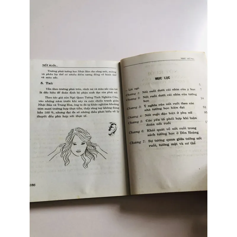 NỐT RUỒI DƯỚI CÁI NHÌN CỦA Y HỌC & TƯỚNG HỌC  735157