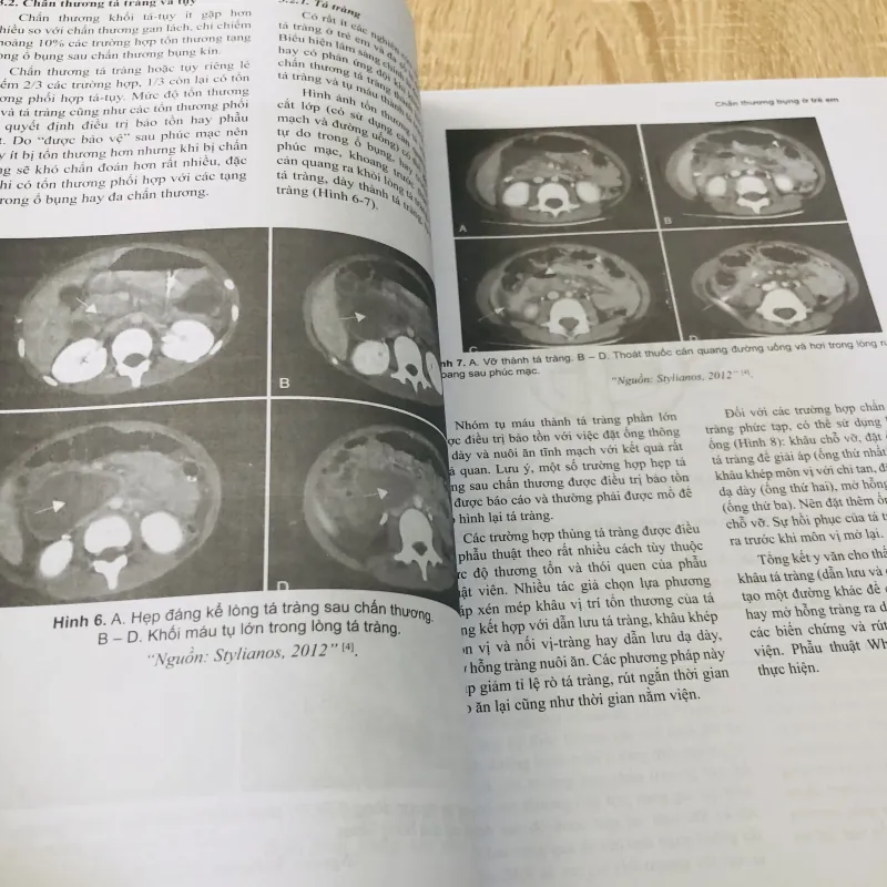 Ngoại Nhi Lâm Sàng - PGS.TS.BS Ttương Nguyễn Uy Linh 933218