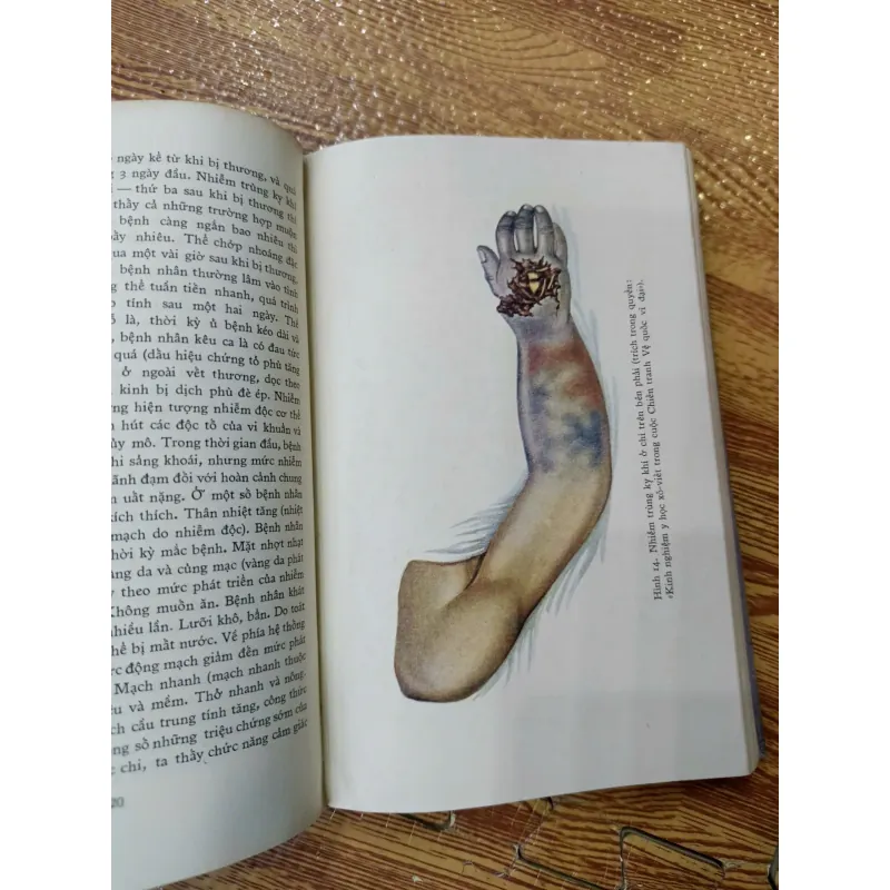 Ngoại khoa dã chiến 1009417