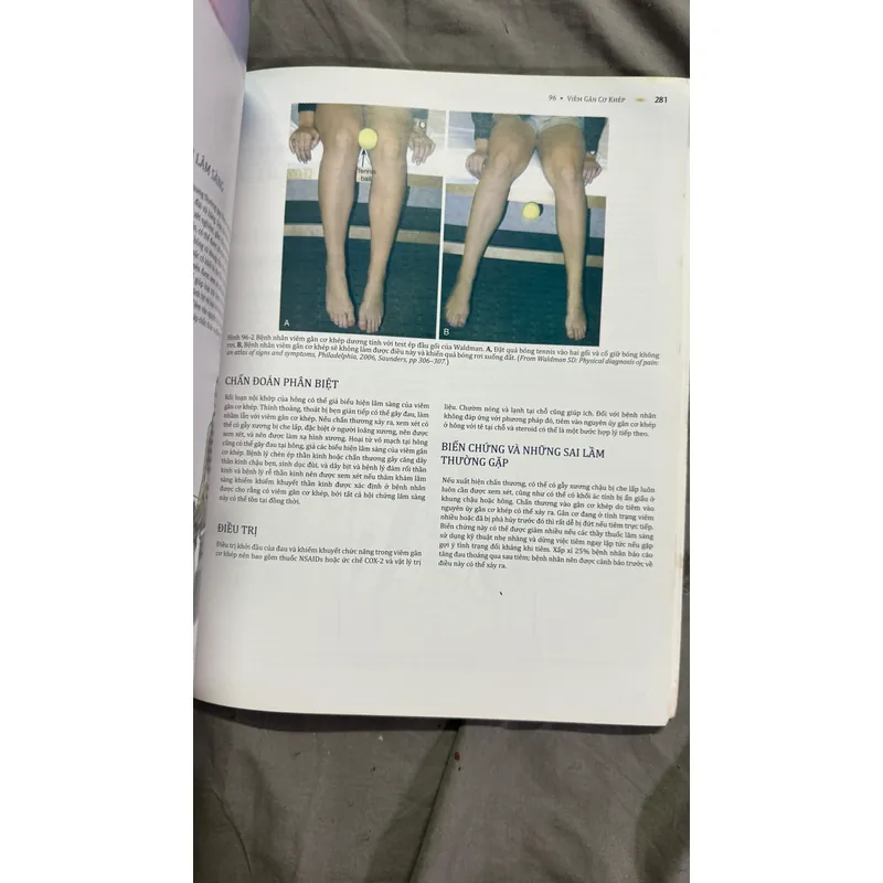 Atlas y khoa Hội chứng đau hiếm gặp  715543
