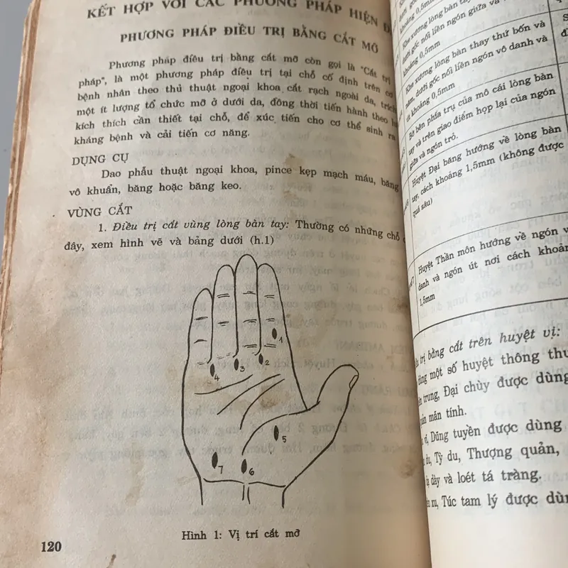 Châm cứu kết hợp cổ truyền với hiện đại, Lê Quý Ngưu 709492