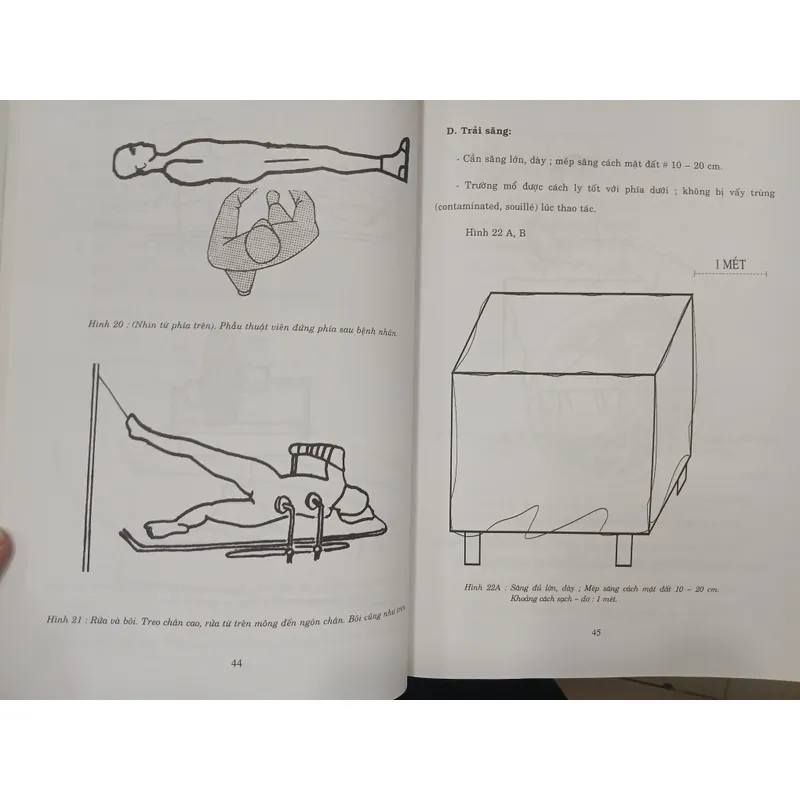 GÃY THÂN XƯƠNG ĐÙI - TỔN THƯƠNG, CHẨN ĐOÁN, ĐIỀU TRỊ 595415