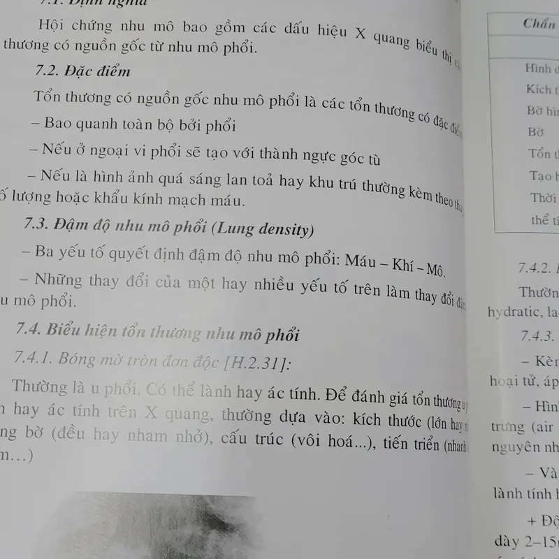 CHẨN ĐOÁN X QUANG  572267