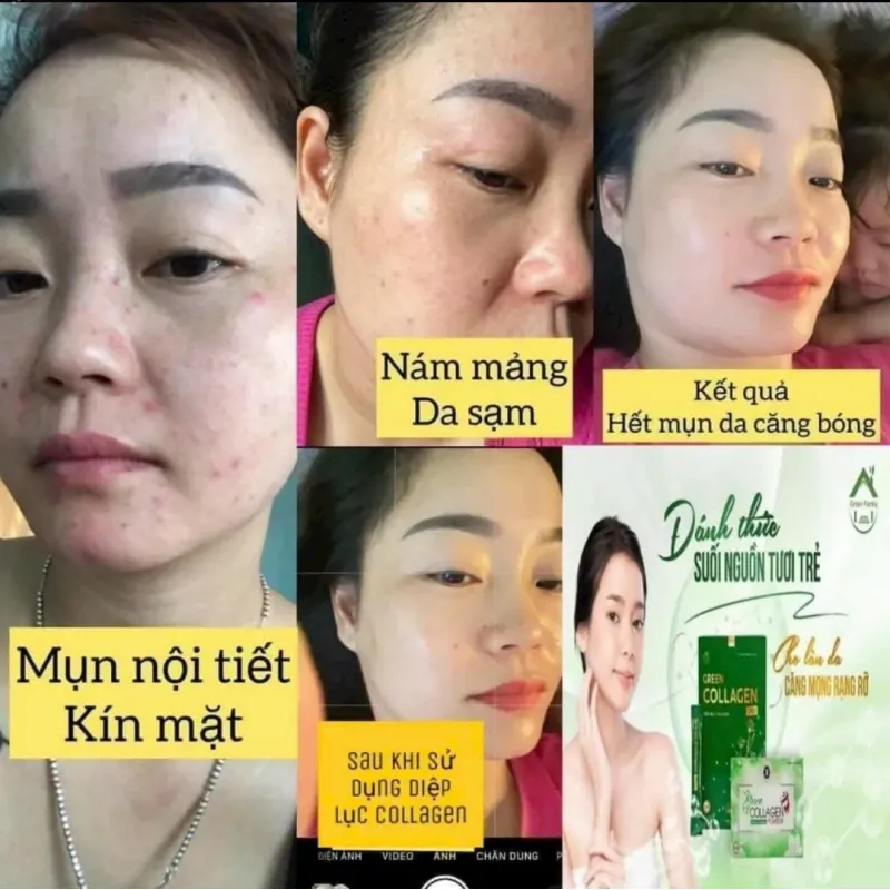 Diệp lục collagen đẹp da 971556