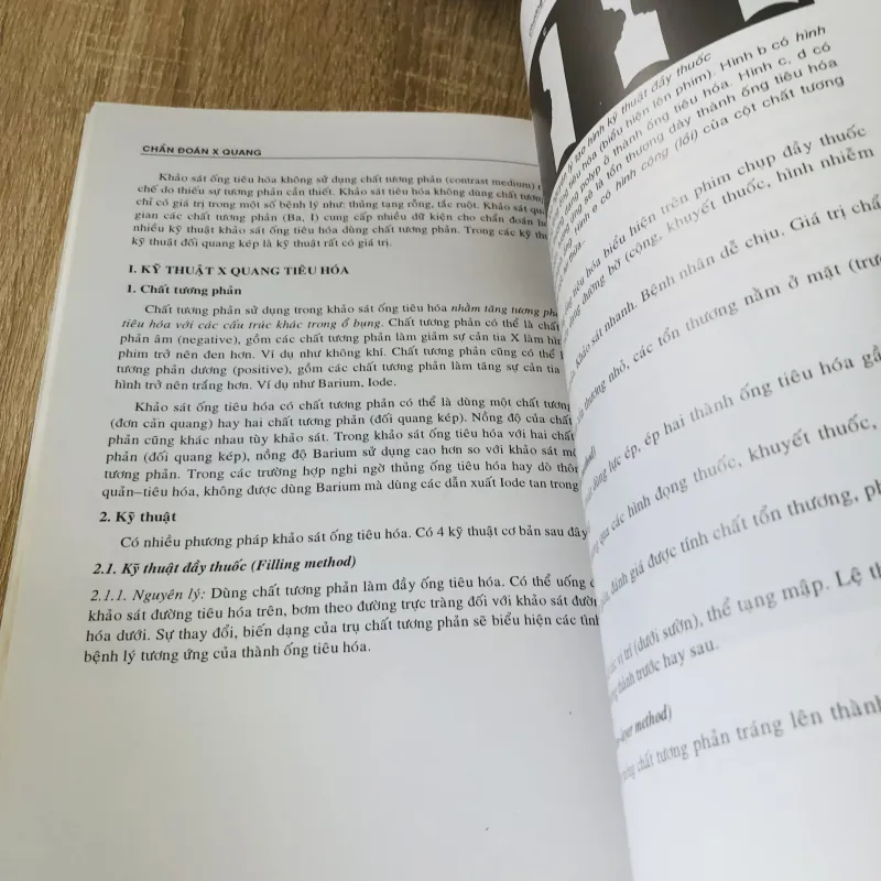 BÀI GIẢNG CHẨN ĐOÁN X QUANG 1004284