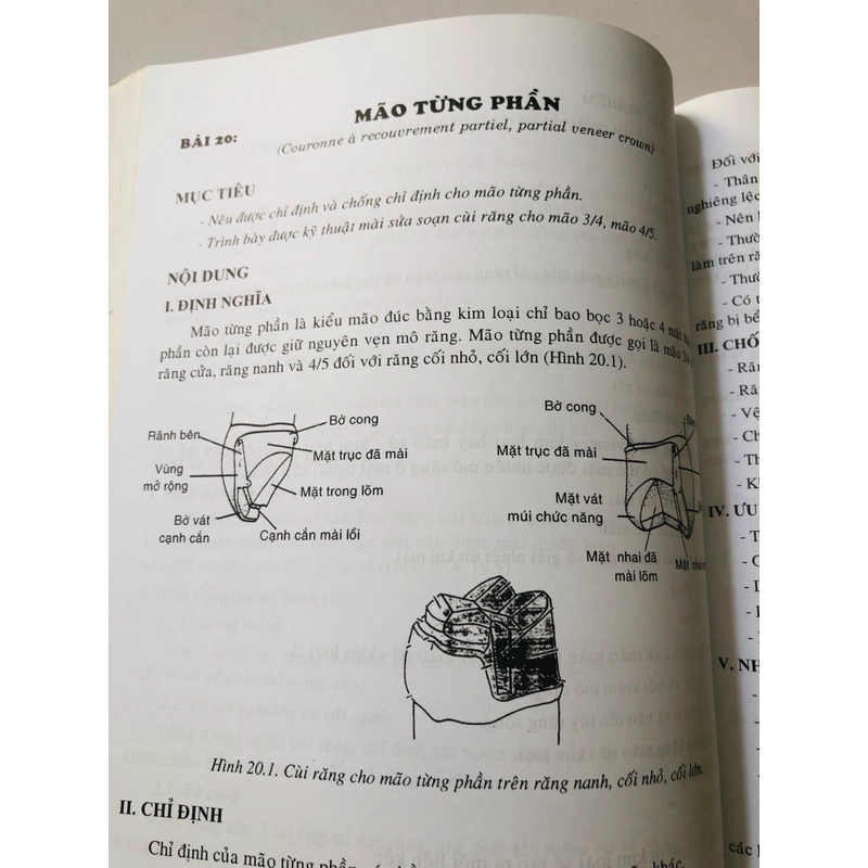 PHỤC HÌNH RĂNG CỐ ĐỊNH  462620