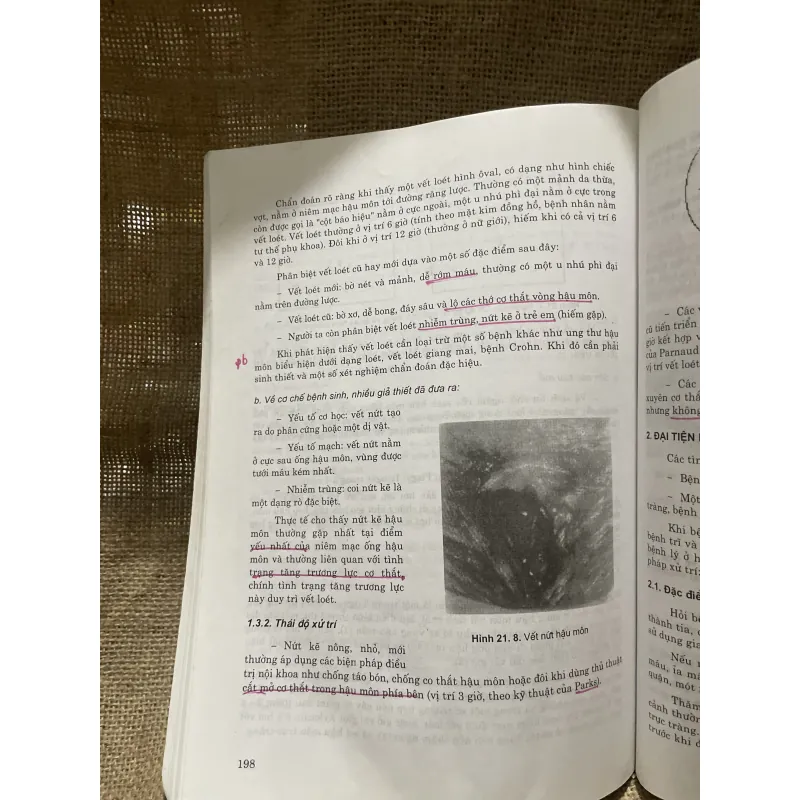 Cấp cứu ngoại khoa tiêu hóa - 200 trang khổ lớn  799812