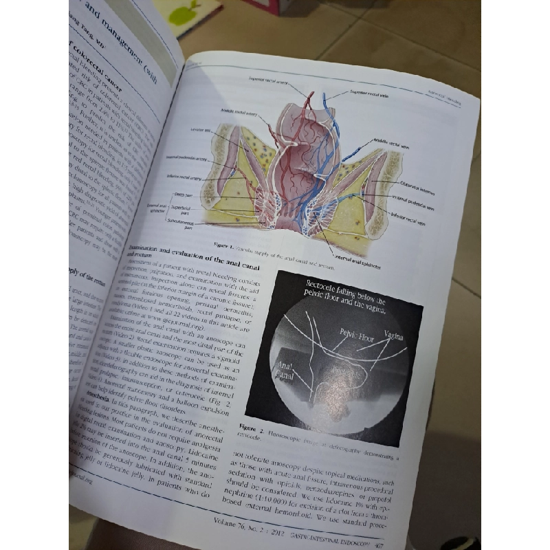 GIE Gastrointestinal Endoscopy volume 76 no 2 8/2012 HCM0808 TẠP CHÍ, THIẾT KẾ, THỜI TRANG 527154