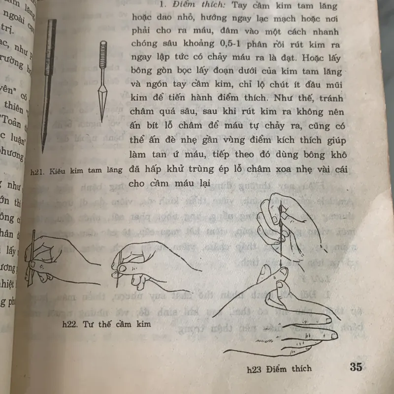 Châm cứu kết hợp cổ truyền với hiện đại, Lê Quý Ngưu 709492