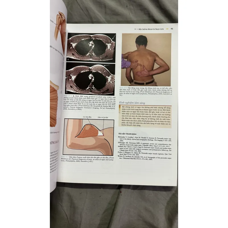 Atlas y khoa Hội chứng đau hiếm gặp  715543