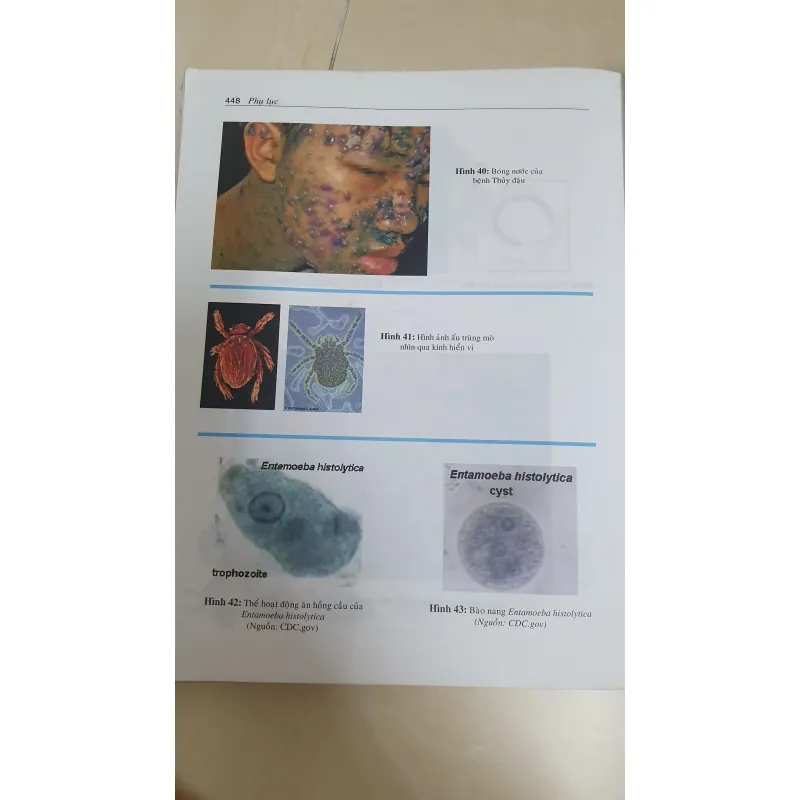 BỆNH TRUYỀN NHIỄM  1019164