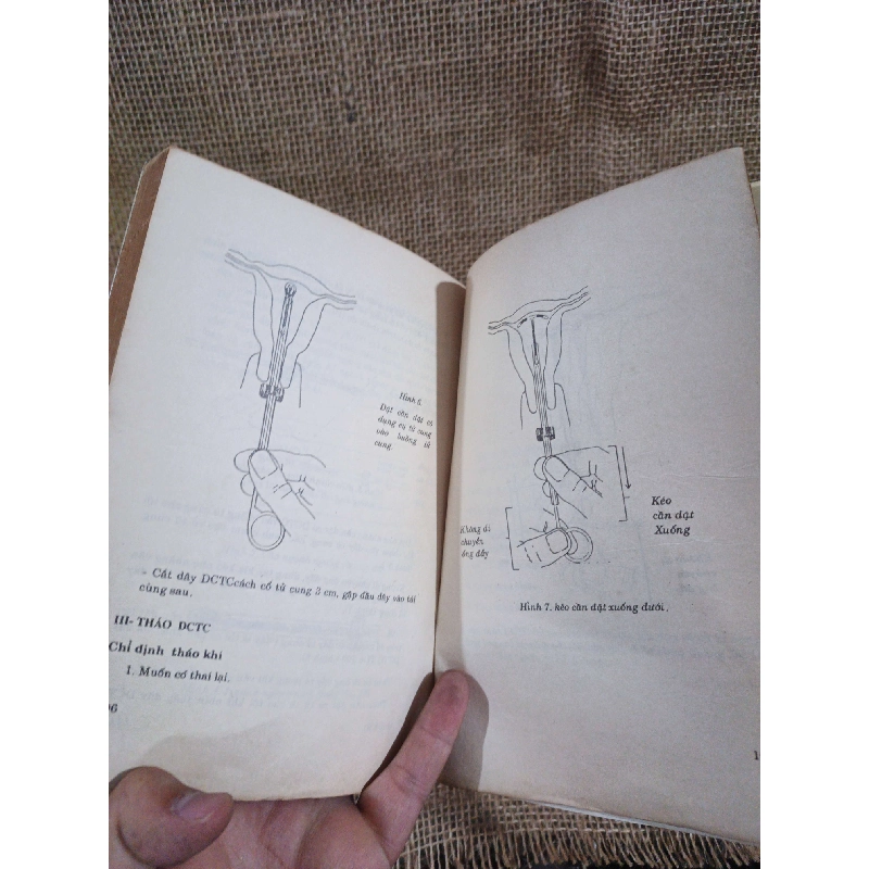 Thủ thuật sản phụ khoa 1990 mới 80% ố (Sách Y học - Sức khỏe - Thể thao) HLSC2404 1028313