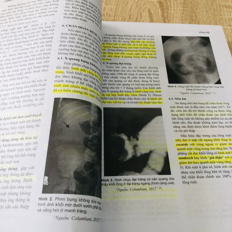 Ngoại Nhi Lâm Sàng - PGS.TS.BS Ttương Nguyễn Uy Linh 933218