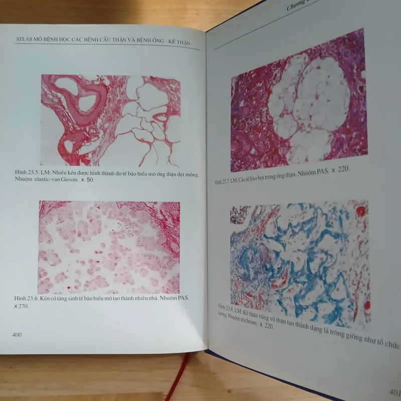 Atlast Mô Bệnh Học Các Bệnh Cầu Thận & Bệnh Ống - Kẽ Thận 799329