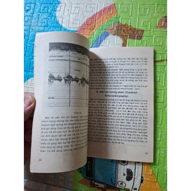 Chẩn đoán siêu âm các bệnh tim mạch 971636