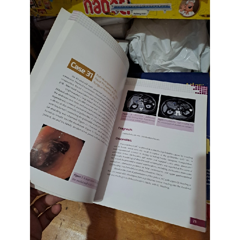 The GI endoscopy Atlas: New Bowel Imaging (NBI) - 6th edition HCM0808 TẠP CHÍ, THIẾT KẾ, THỜI TRANG 527255