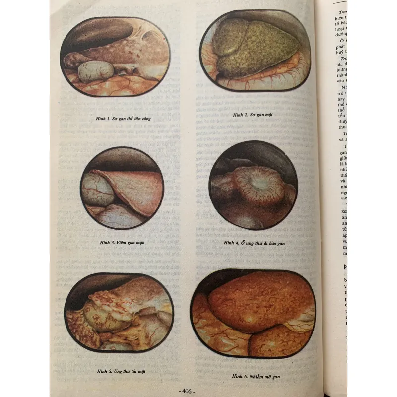 Bách khoa thư bệnh học 2, in năm 1994 1009151