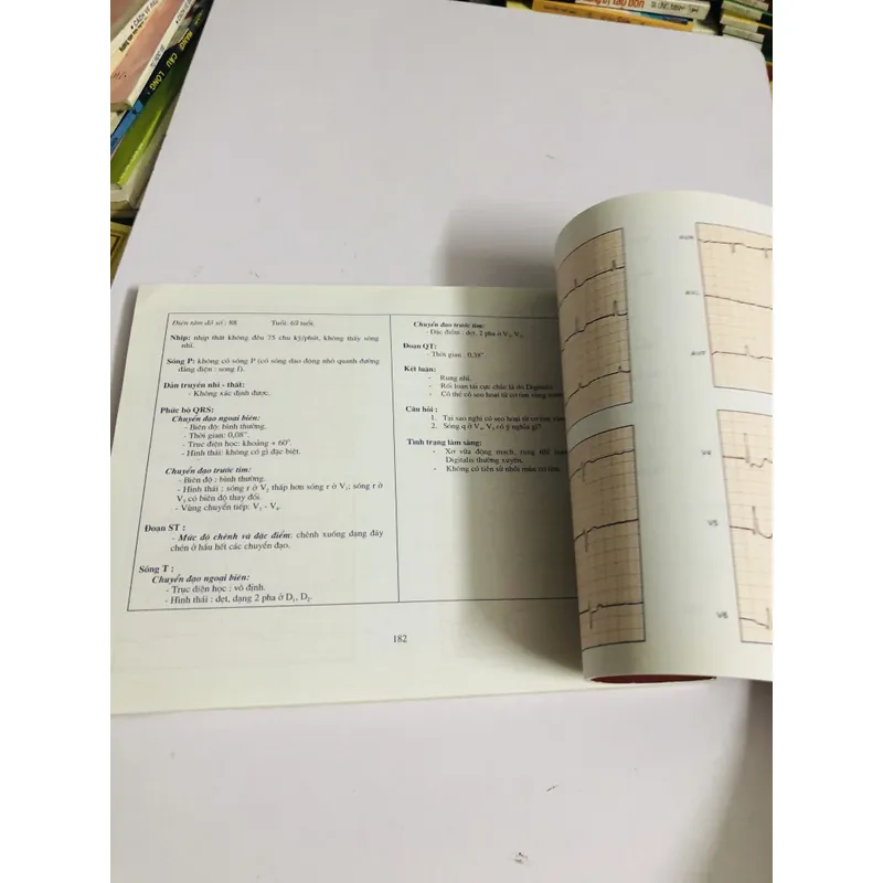 BÀI TẬP ĐIỆN TÂM ĐỒ (M. Englert – R. Bernard) 598068