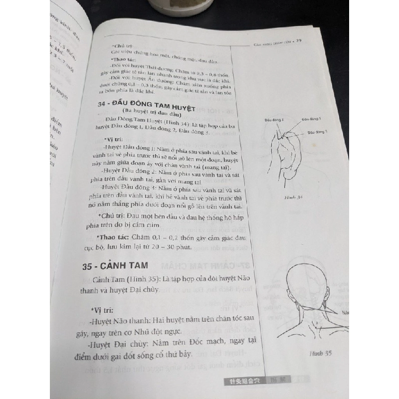 Cẩm nang thực hành chăm cứu - Lưu Viêm 400965