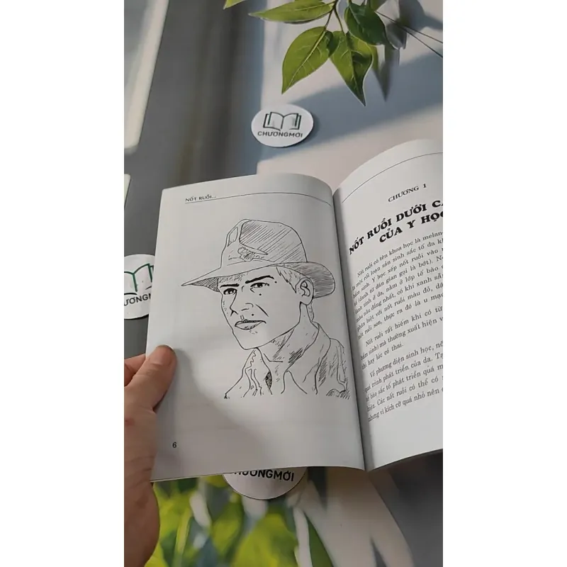 Nốt Ruồi Dưới Cái Nhìn Y Học & Tướng Học - Như Hùng 727280