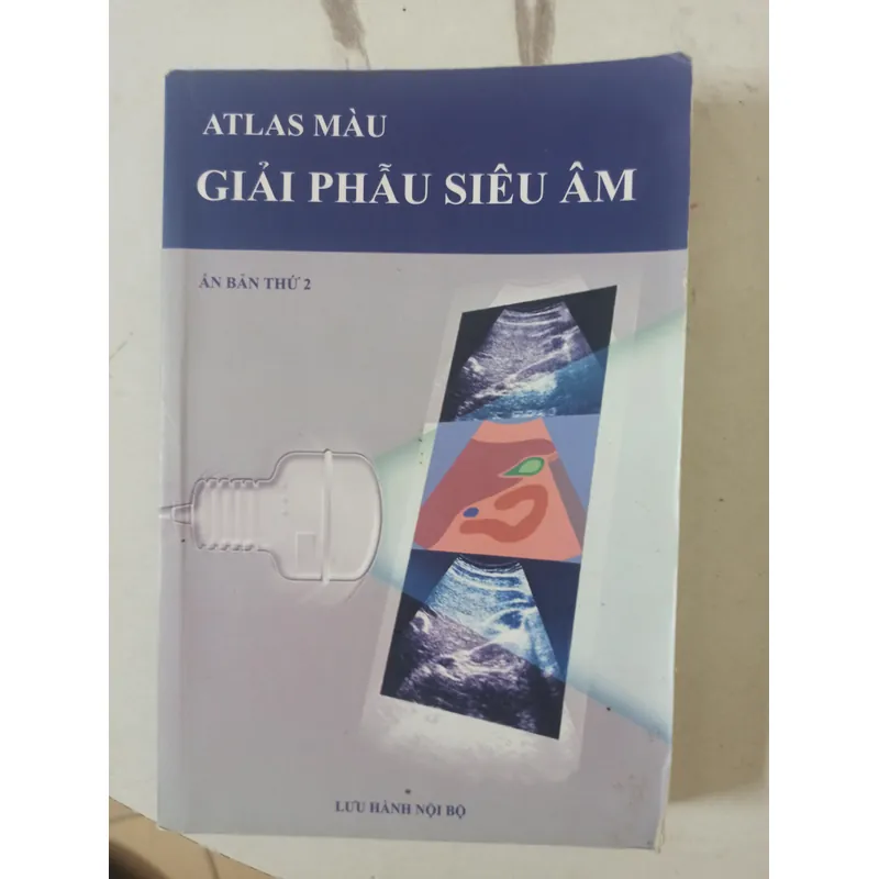 Siêu âm màu 595581
