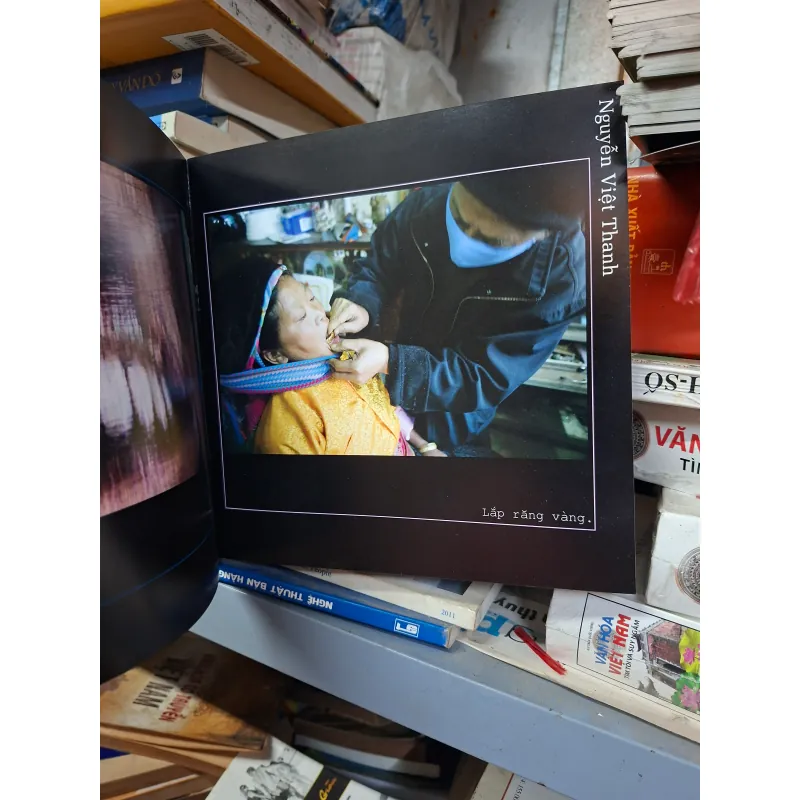 Răng và tóc  1001725