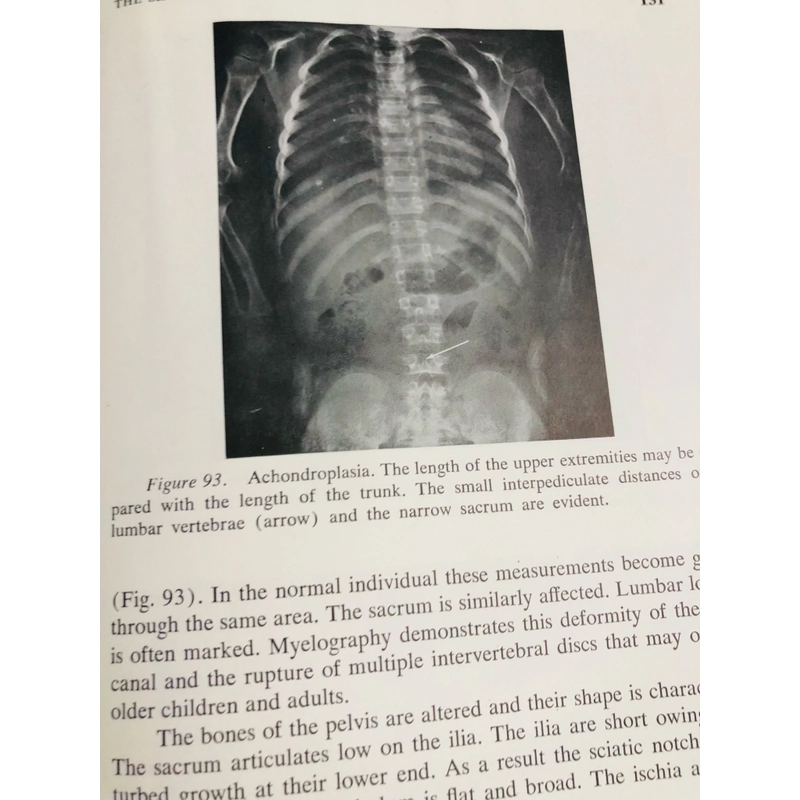 ORTHOPEDIC DISEASE  PHYSIOLOGY  PATHOLOGY  RADIOLOGY  470552