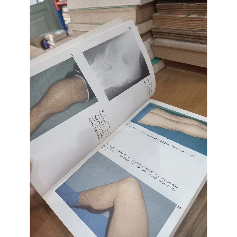 Diagnostic picture tests in injury in sport - J.G.P. Williams 1026695