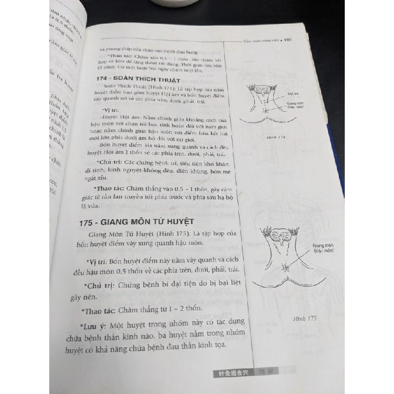 Cẩm nang thực hành chăm cứu - Lưu Viêm 400965