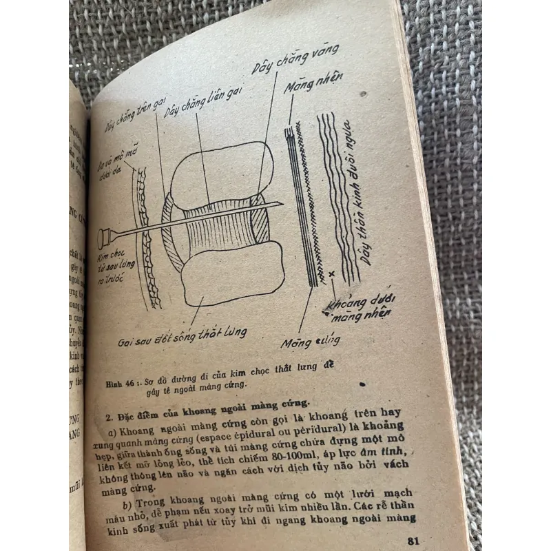 Phương pháp gây tê - GS Trương Công Trung  1025097