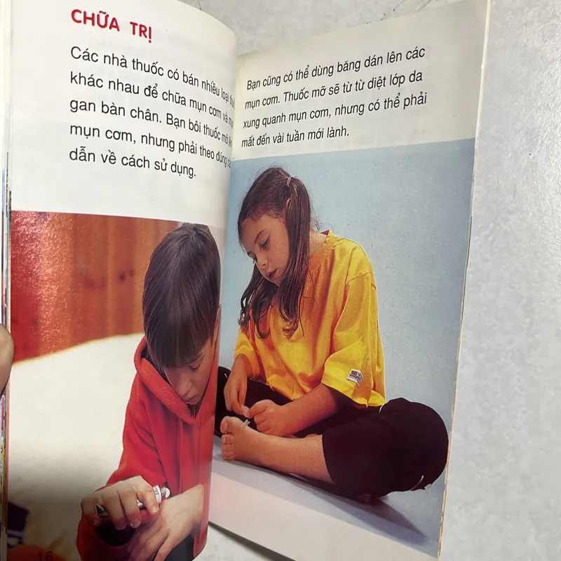 Mụn cơm - bệnh lây 589695