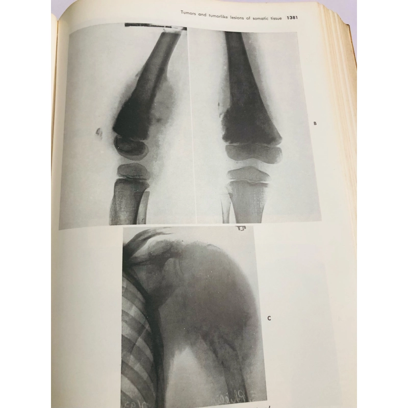 CAMPBELL’S OPERATIVE ORTHOPAEDICS (phẫu thuật chỉnh hình) 470882