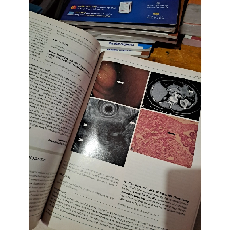 GIE Gastrointestinal Endoscopy volume 76 no 1 7/2012 HCM0808 TẠP CHÍ, THIẾT KẾ, THỜI TRANG 527243