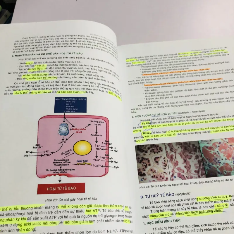 BÀI GIẢNG LÝ THUYẾT GIẢI PHẪU BỆNH  780441