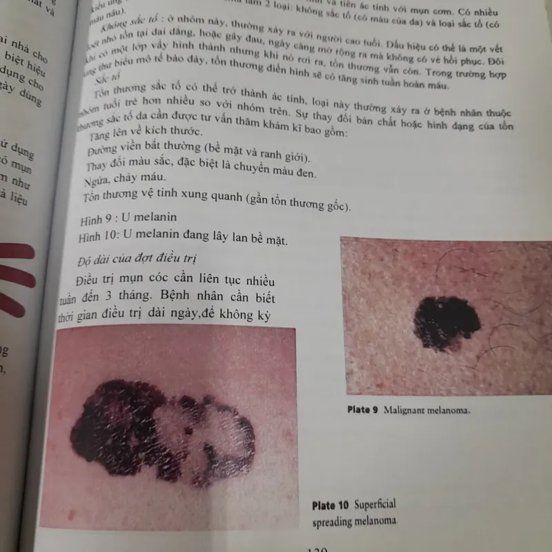 Các triệu chứng ở nhà thuốc. Hướng dẫn xử lý. Ấn bản tiếng Việt. Alison Blenkknsopp 602657