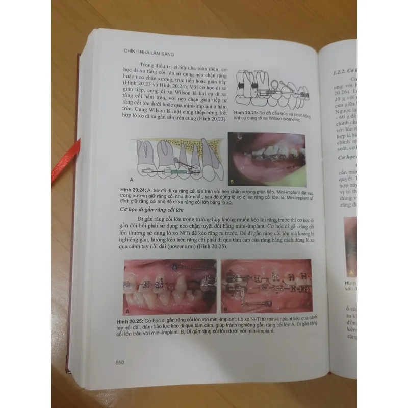 CHỈNH NHA LÂM SÀNG TẬP 1 689476